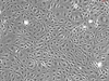 Human Pancreatic Microvascular Endothelial Cells, Passage 1