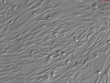Human Seminal Vesicle Smooth Muscle Cells