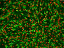 Human Intrahepatic Biliary Epithelial Cells, Passage 1