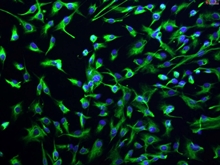 Human Intrahepatic Biliary Epithelial Cells, Passage 1