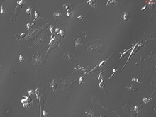 Human Hepatic Macrophages