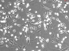 Human Hepatic Macrophages