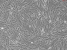 Human Uterine Fibroblasts