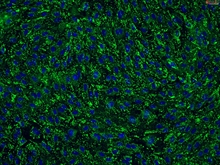 Human Cervical Microvascular Endothelial Cells, Passage 1