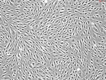 Human Cervical Microvascular Endothelial Cells, Passage 1