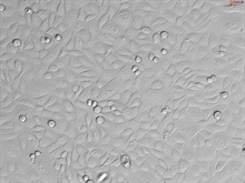 Human Cervical Epithelial Cells, Passage 1