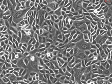 Human Cervical Epithelial Cells, Passage 1