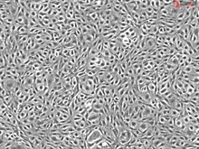 Human Adipose Microvascular Endothelial Cells, Passage 1