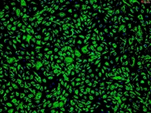 Human Adipose Microvascular Endothelial Cells, Passage 1