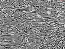 Human Preadipocytes-subcutaneous