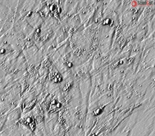 Human Preadipocytes-subcutaneous