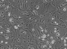 CD1 Mouse Hepatic Stellate Cells