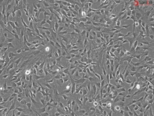 Human Primary Brain Vascular Smooth Muscle Cells, Passage 1