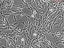 Human Brain Vascular Adventitial Fibroblasts, Passage 1