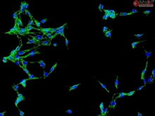 Human Brain Vascular Adventitial Fibroblasts, Passage 1