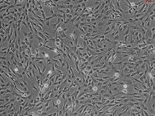 Human Brain Vascular Pericytes, Passage 1