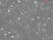 Primary Human Choroid Plexus Epithelial Cells