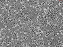 Human Choroid Plexus Fibroblasts, Passage 0