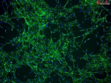 Human Choroid Plexus Fibroblasts, Passage 0