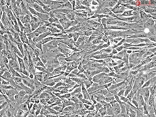 Human Meningeal Cells, Passage 1