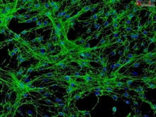 Human Meningeal Cells, Passage 1