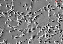 Human Oligodendrocyte Precursor Cells, HOPC