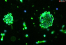 Human Oligodendrocyte Precursor Cell-oligospheres HOPC-os