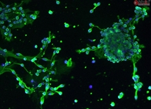 Human Oligodendrocyte Precursor Cell-oligospheres HOPC-os