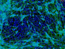 iPSC-derived Human Neural Stem Cells