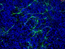 iPSC-derived Human Neural Stem Cells