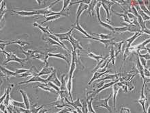 Cryopreserved Human Primary Schwann Cells, Passage 1, 10 population doublings