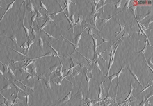 Cryopreserved Human Primary Schwann Cells, Passage 1, 10 population doublings