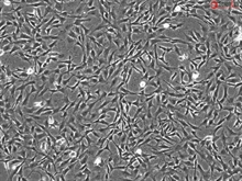 Human Astrocytes-cerebellar, GFAP+, Passage 1