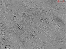 Human Astrocytes-hippocampal, GFAP+, Passage 1
