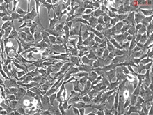 Human Astrocytes-brain stem, GFAP+, Passage 1