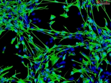 Human Astrocytes-brain stem, GFAP+, Passage 1
