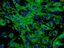 Human Dermal Microvascular Endothelial Cells, HDMEC, Passage 1
