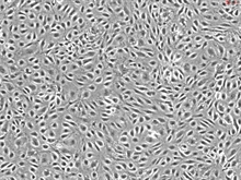 Human Dermal Microvascular Endothelial Cells-adult, Passage 1