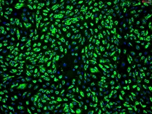 Human Dermal Microvascular Endothelial Cells-adult, Passage 1