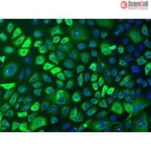 Human Epidermal Keratinocytes-adult, Passage 0