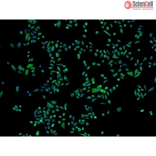 Human Epidermal Keratinocytes-fetal