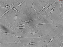 Human Epidermal Melanocytes-light