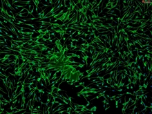 Human Epidermal Melanocytes-light