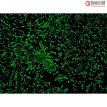 Human Epidermal Melanocytes-light