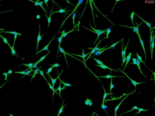 Human Epidermal Melanocytes-dark