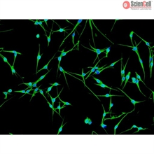 Human Epidermal Melanocytes-dark