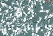 Human Epidermal Melanocytes-adult