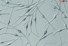 Human Epidermal Melanocytes-adult