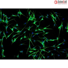 Human Epidermal Melanocytes-adult