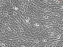 HLA-A*01 or HLA-A*02 Positive Human Skin Primary Dermal Fibroblasts, Passage 1